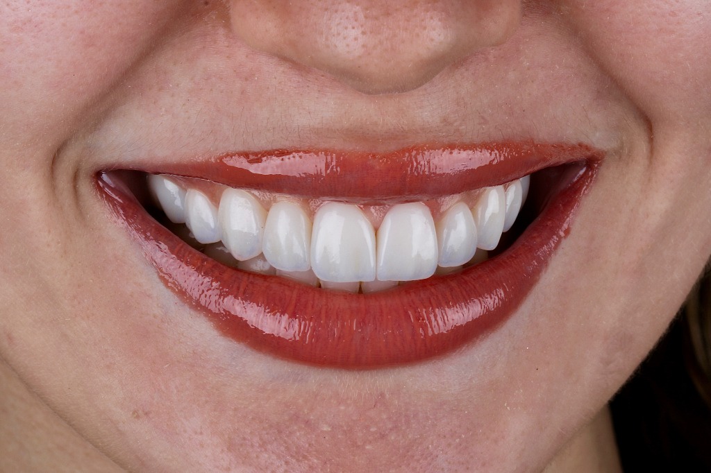 Sorriso Perfeito